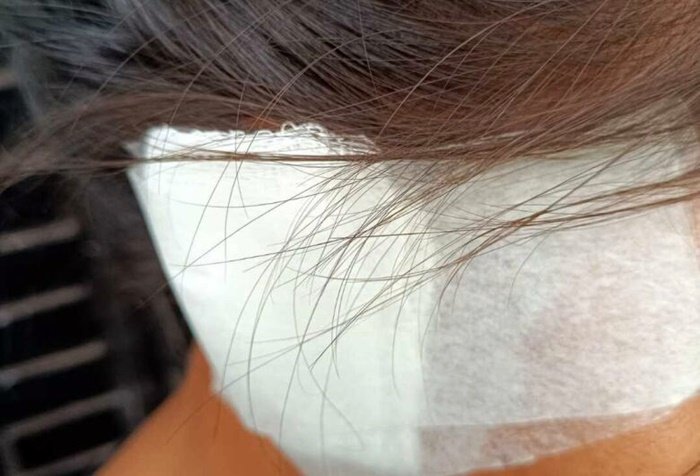 Mulher orelha mordia Dourados